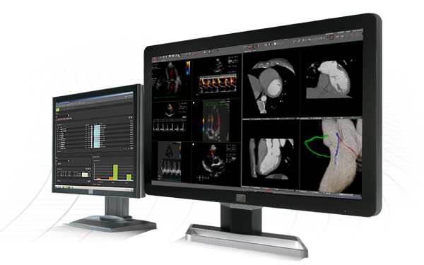 Pro Medicus Visage RIS PACS3 screens 600pxw